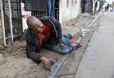 A Mozambican, Emmanuel Sithole left to die in Alexandra township during the xenophobic attack in Johannesburg, South Africa.