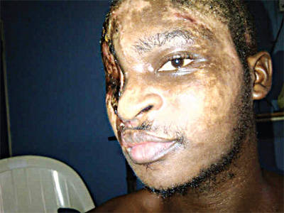Opaleye ..after the accident