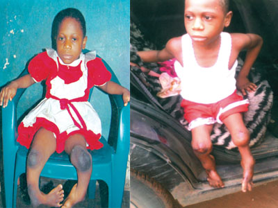 Physically-challenged kids
