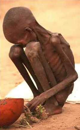 starving child