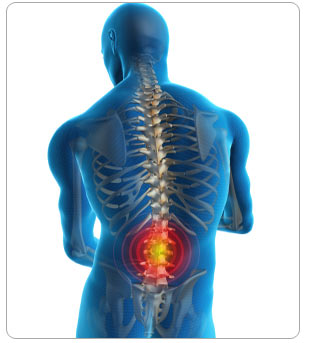 Spinal-Cord-Injury