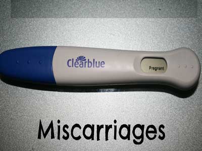 miscarriage