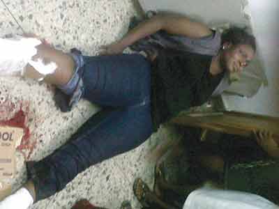 Oyesanya-Ayaoge is waiting for help to walk again 