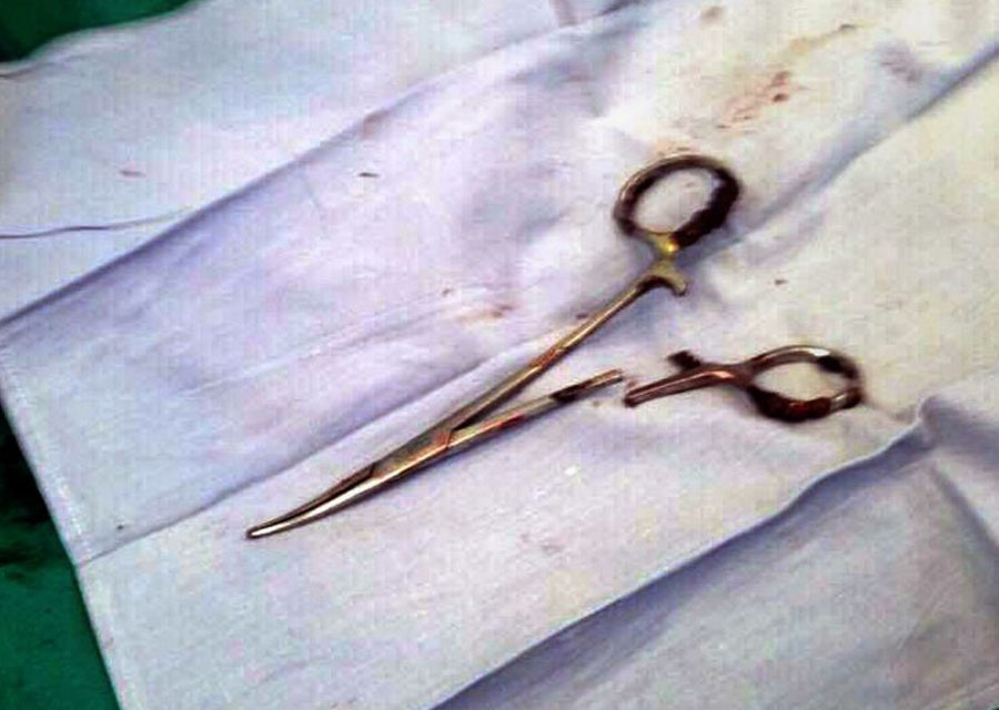 A pair of scissors which was removed from a patient's abdomen after being left behind during a surgery 18 years ago, at a clinic in the northern Vietnamese city of Thai Nguyen (AFP Photo/VIETNAM NEWS AGENCY) 