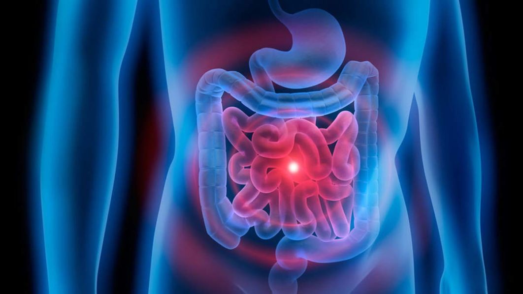 Healthy-gut