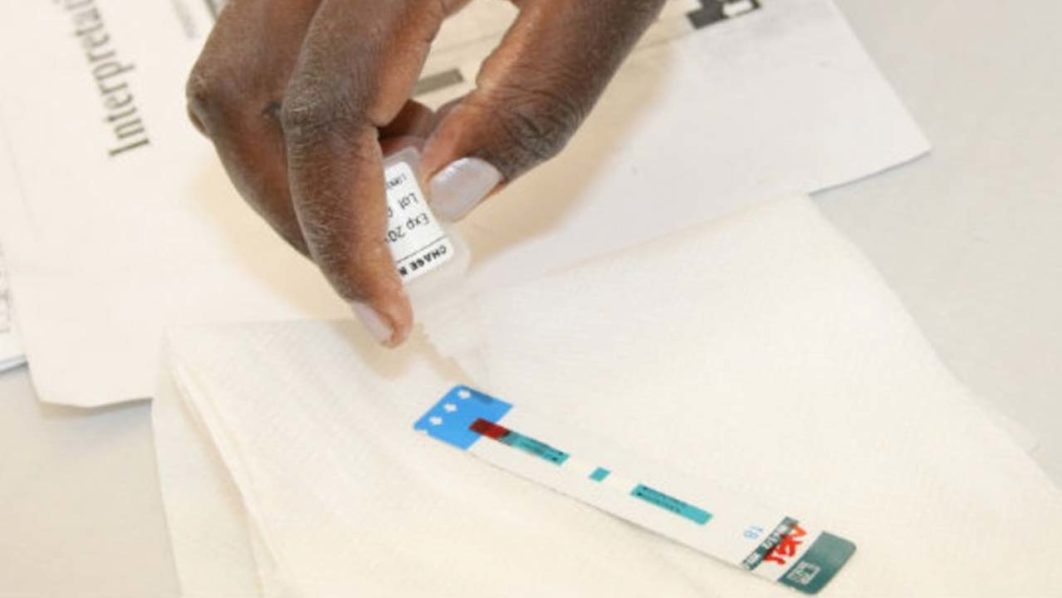 HIV