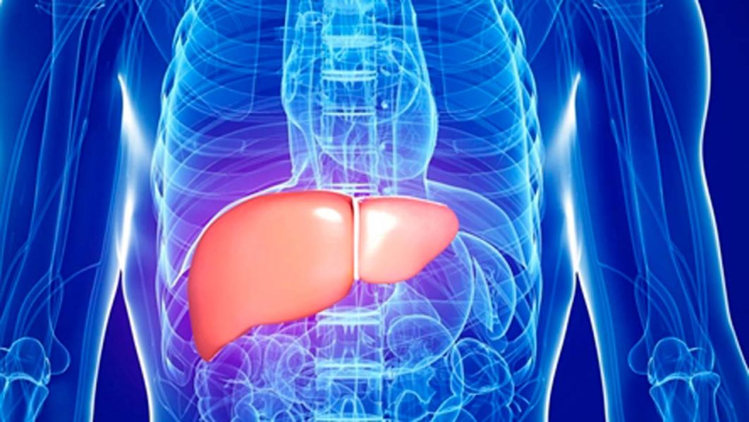 hepatitis