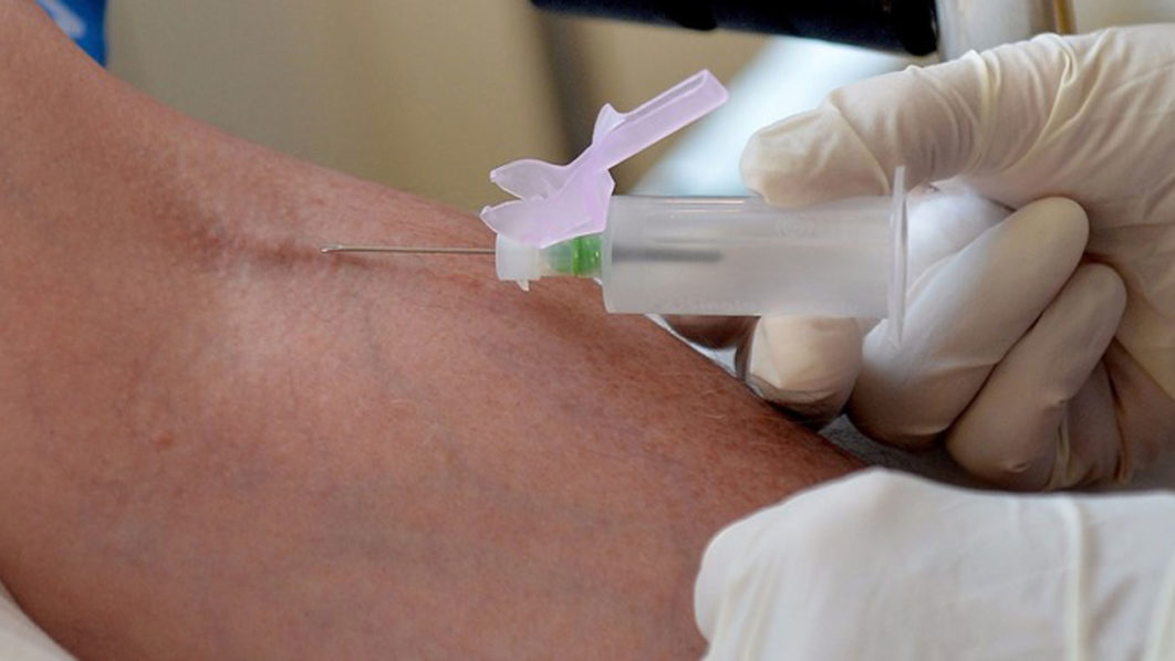 Pioneering-treatment