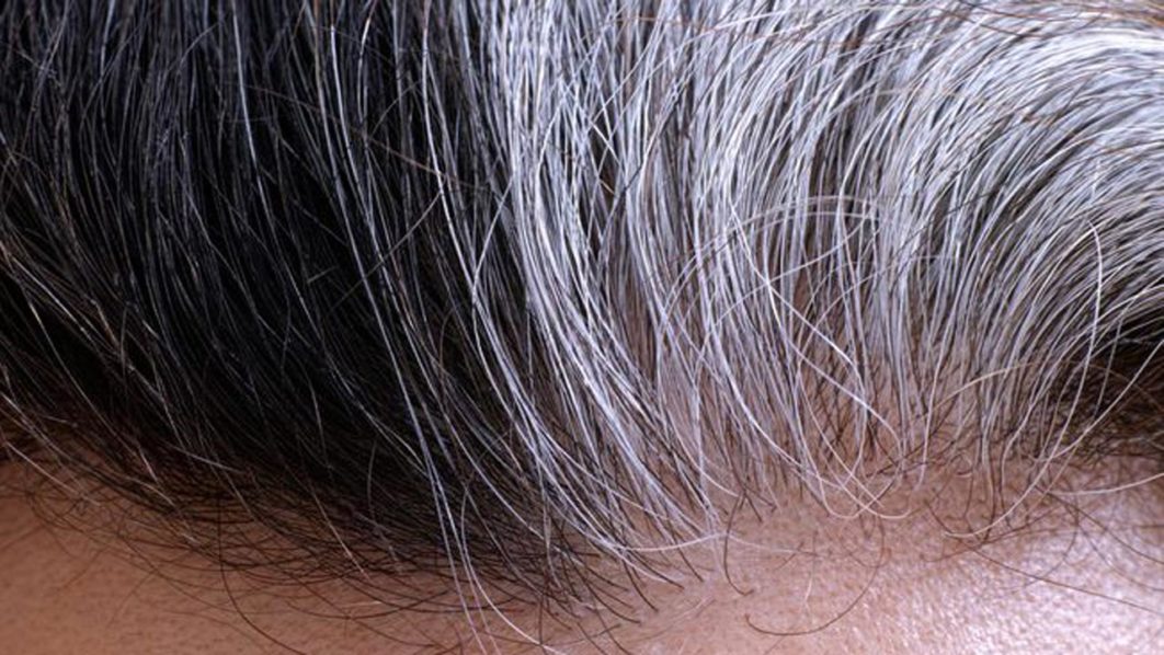 gray-hair-roots.jpg.653x0_q80_crop-smart