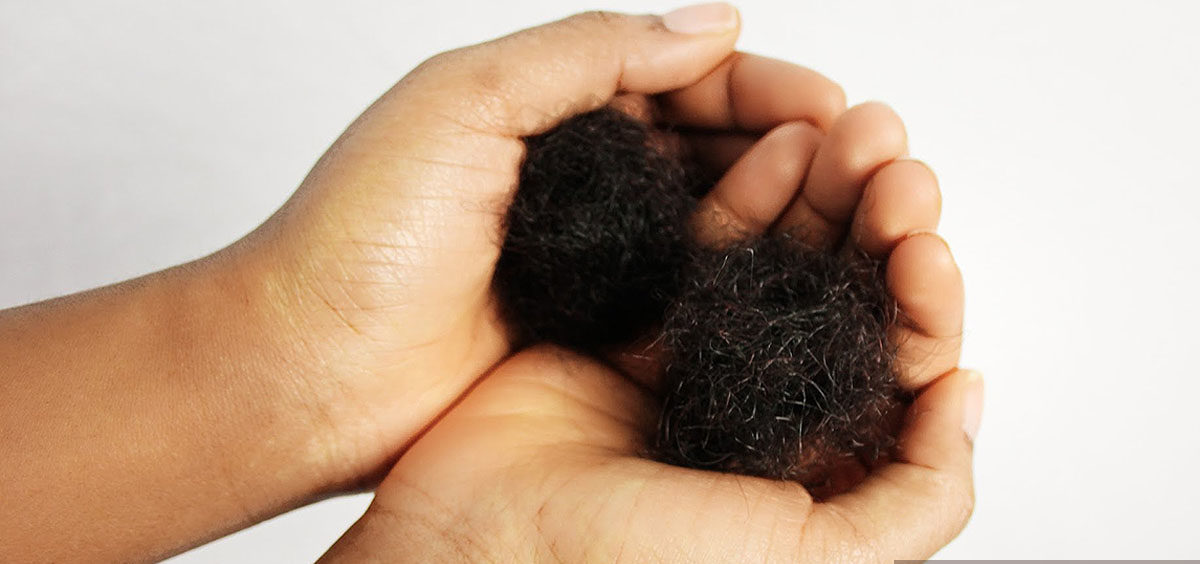 Hair loss photo gettyimages