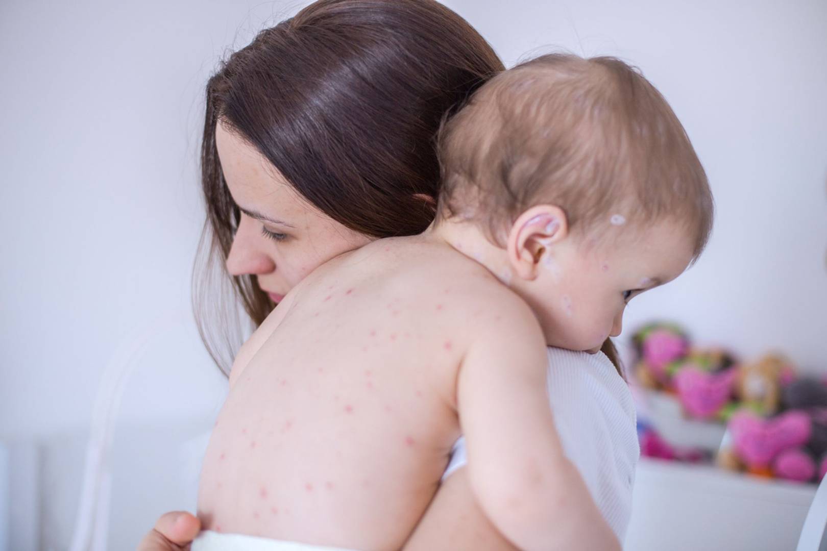 Measles outbreak in Europe photo Wired UK