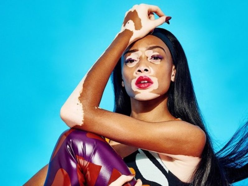 Winnie Harlow Photo WMagazine
