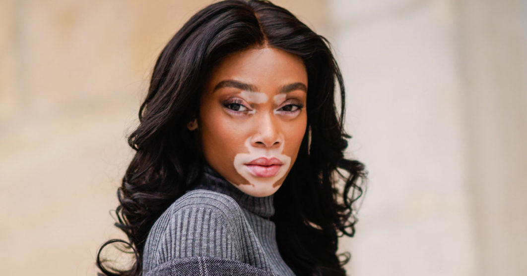 Winnie Harlow Photo – The Cut