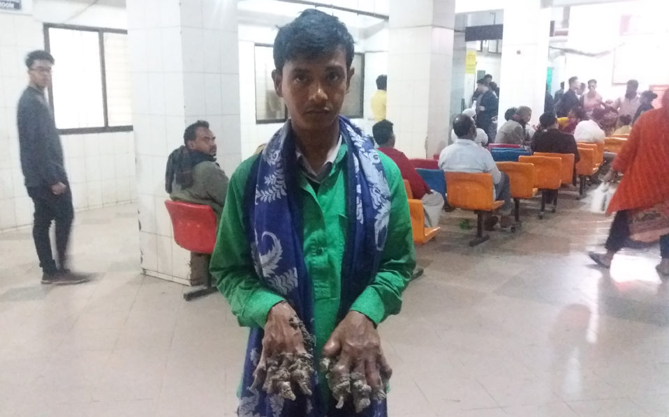 BANGLADESH-HEALTH