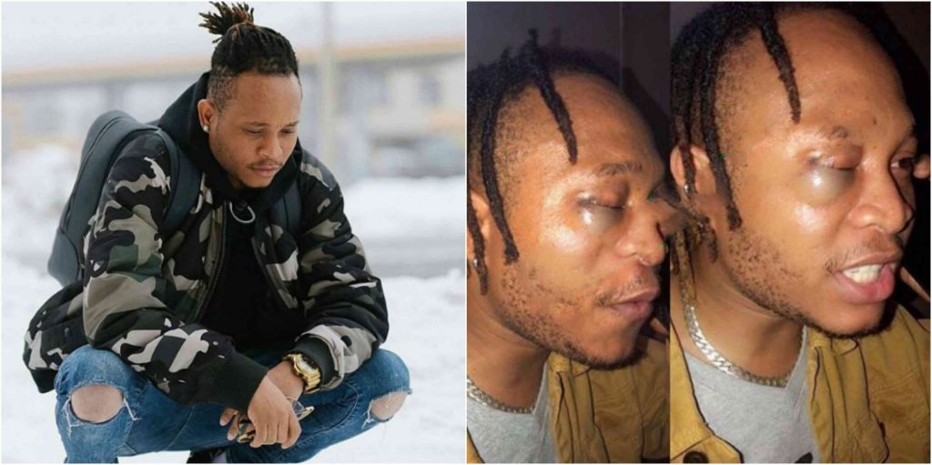 Former-YBNL-singer-Viktoh-beaten-by-police-Report-lailasnews-3-1024×511