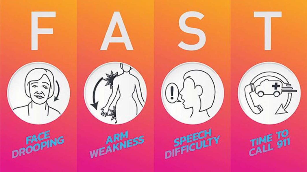 Stroke-Symptoms-and-Causes