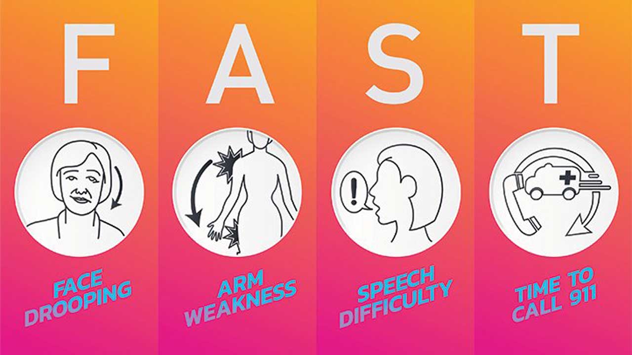 Stroke-Symptoms-and-Causes