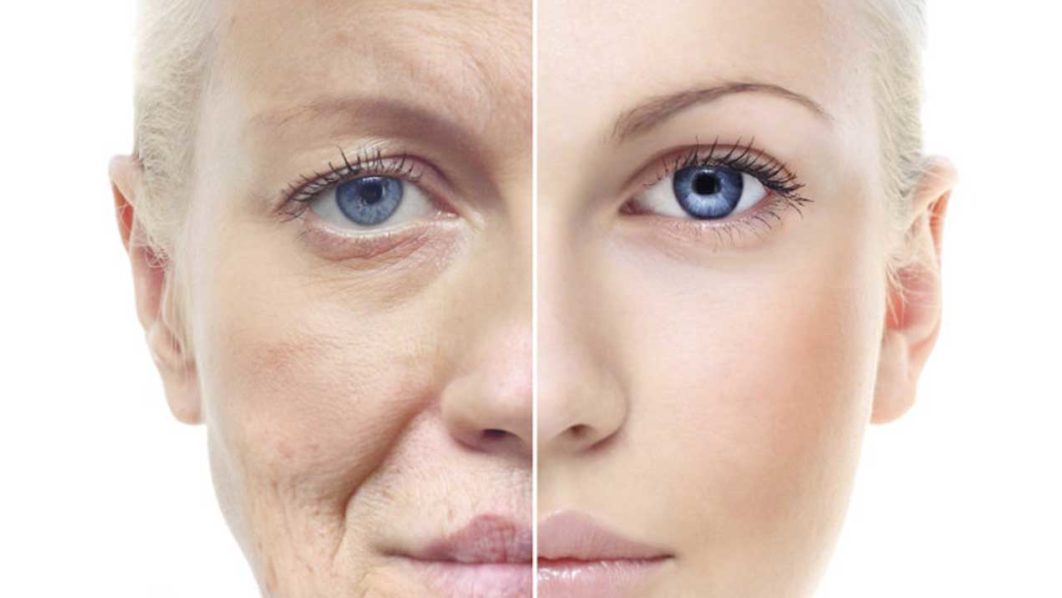 anti_aging