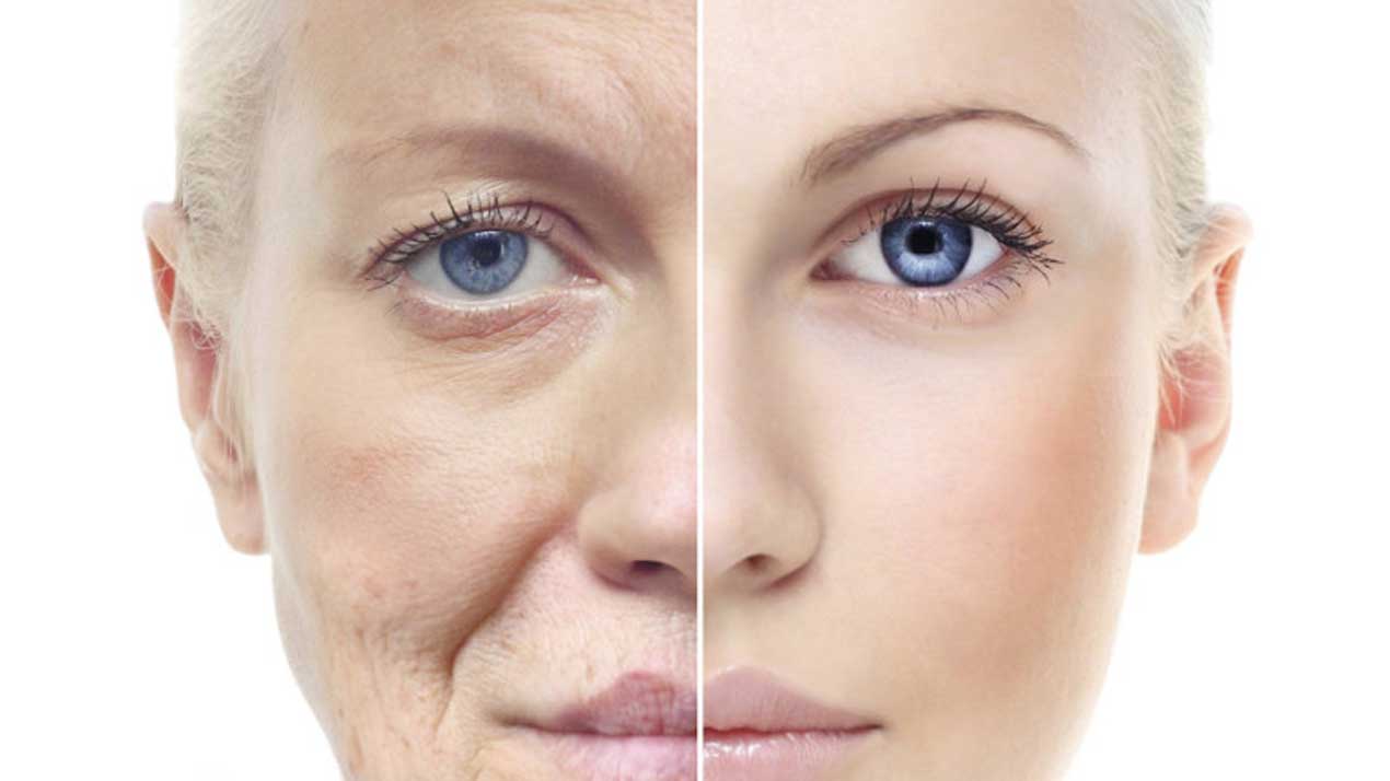 anti_aging