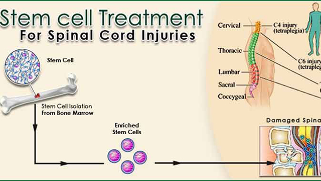 Stem cells