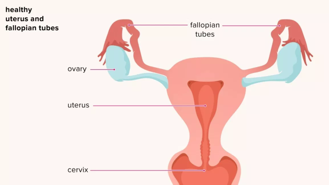Pelvic Inflammatory Disease. Photo rchsd