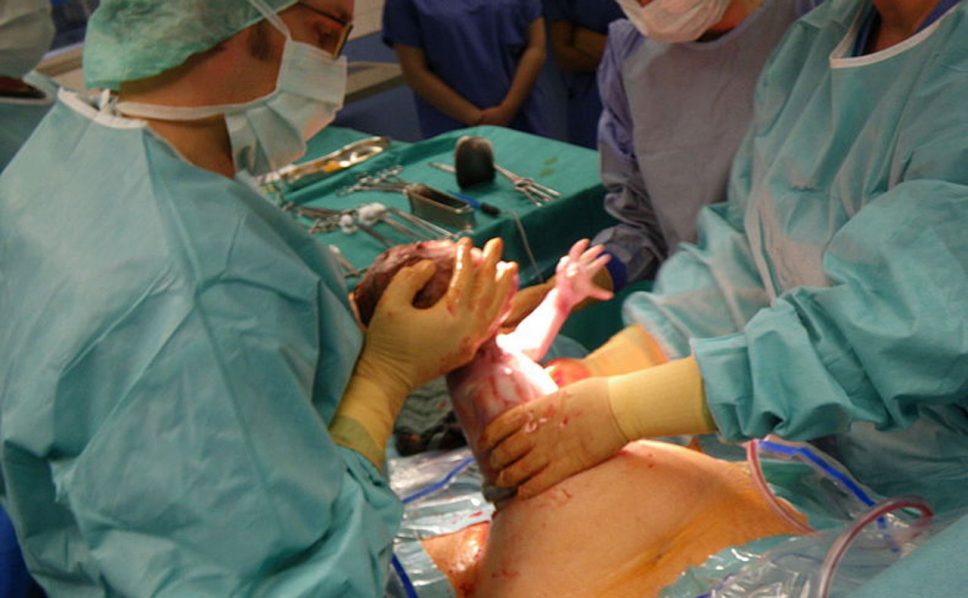 C-section