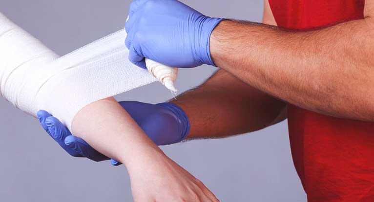 Burns treatment