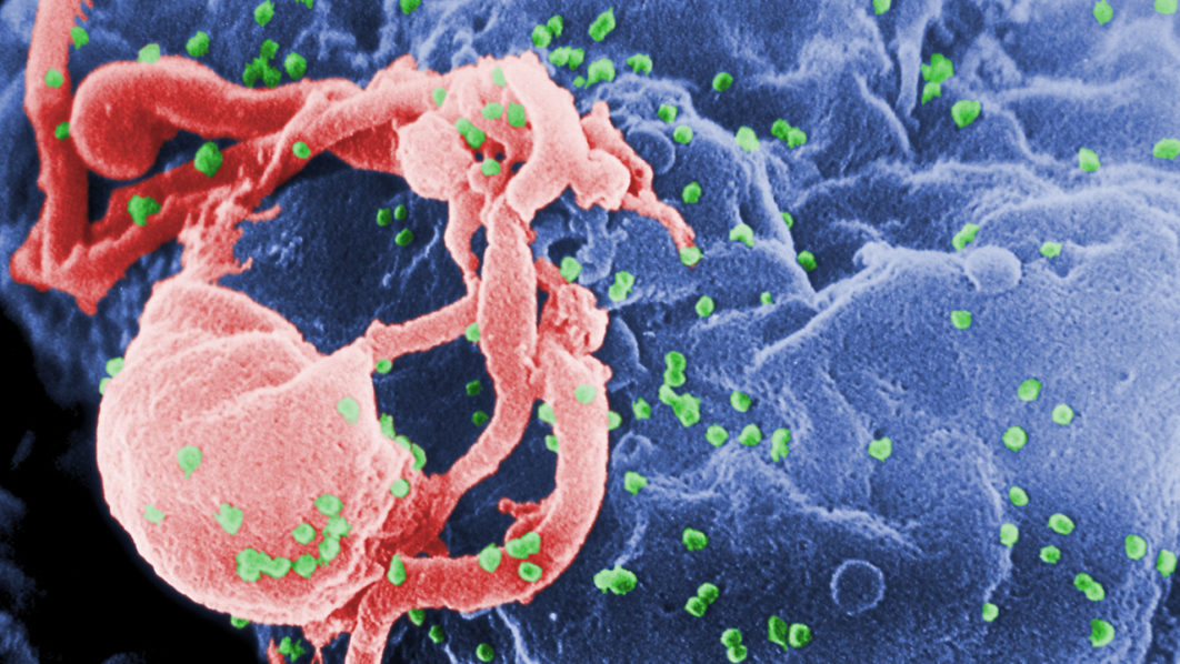 HIV