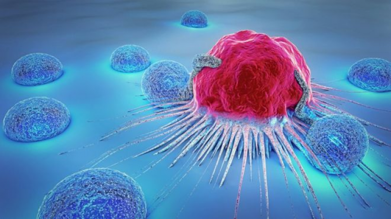 Cancer.-Photo-BBC
