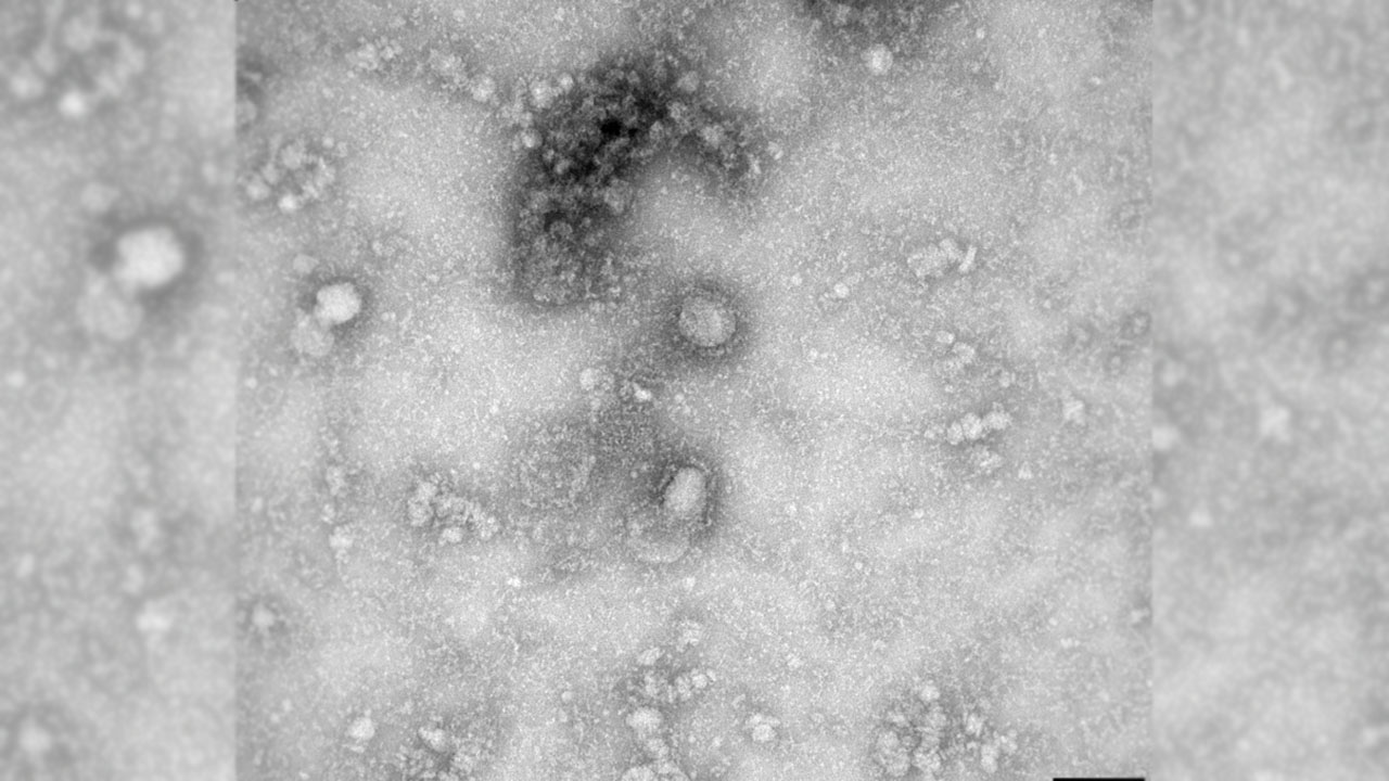 A Transmission Electron Microscopy image of the first isolated case of the coronavirus