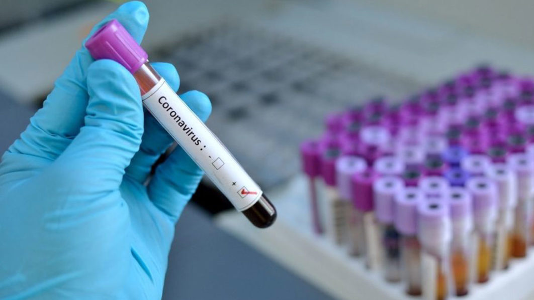 Coronavirus