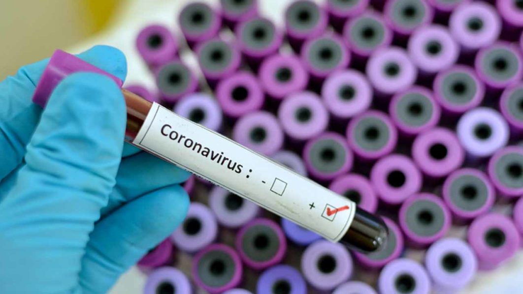 coronavirus