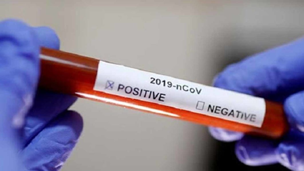 coronavirus