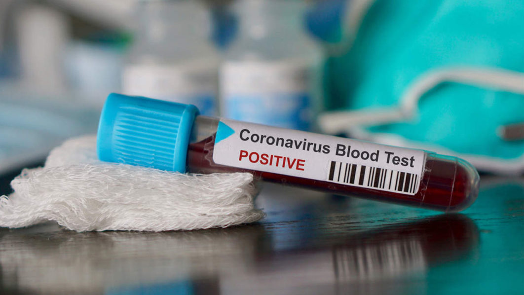 COVID-19 blood
