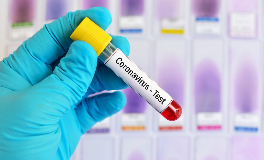 Cornoavirus-1024×622