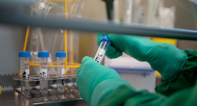 Coronavirus-now-in-France