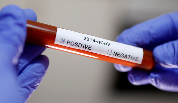 coronavirus-in-nigeria1