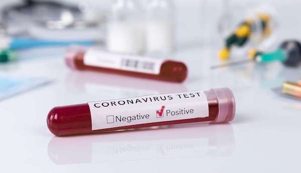 Coronavirus-test-positive