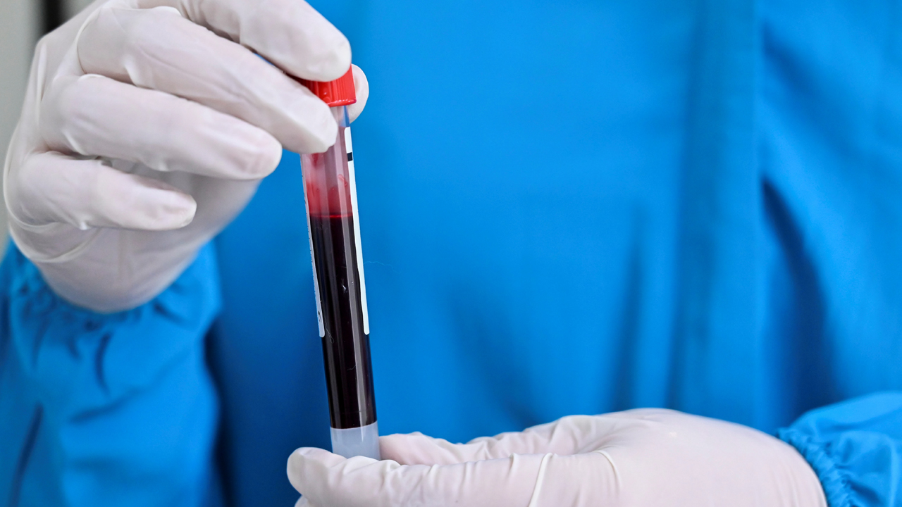 COLOMBIA-HEALTH-VIRUS