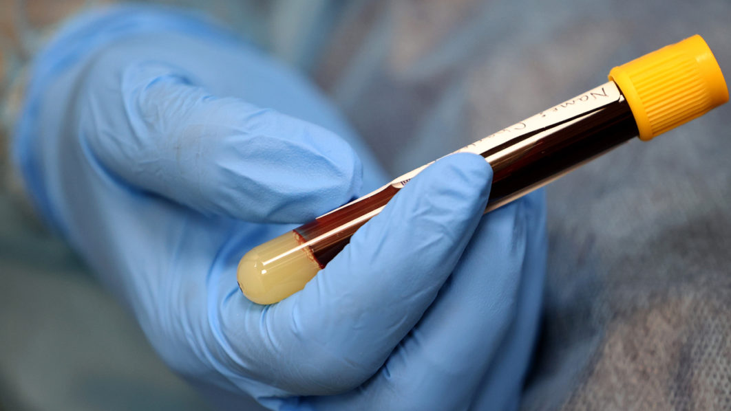 Washington DC District Government Offers Free Antibody Tests For COVID-19