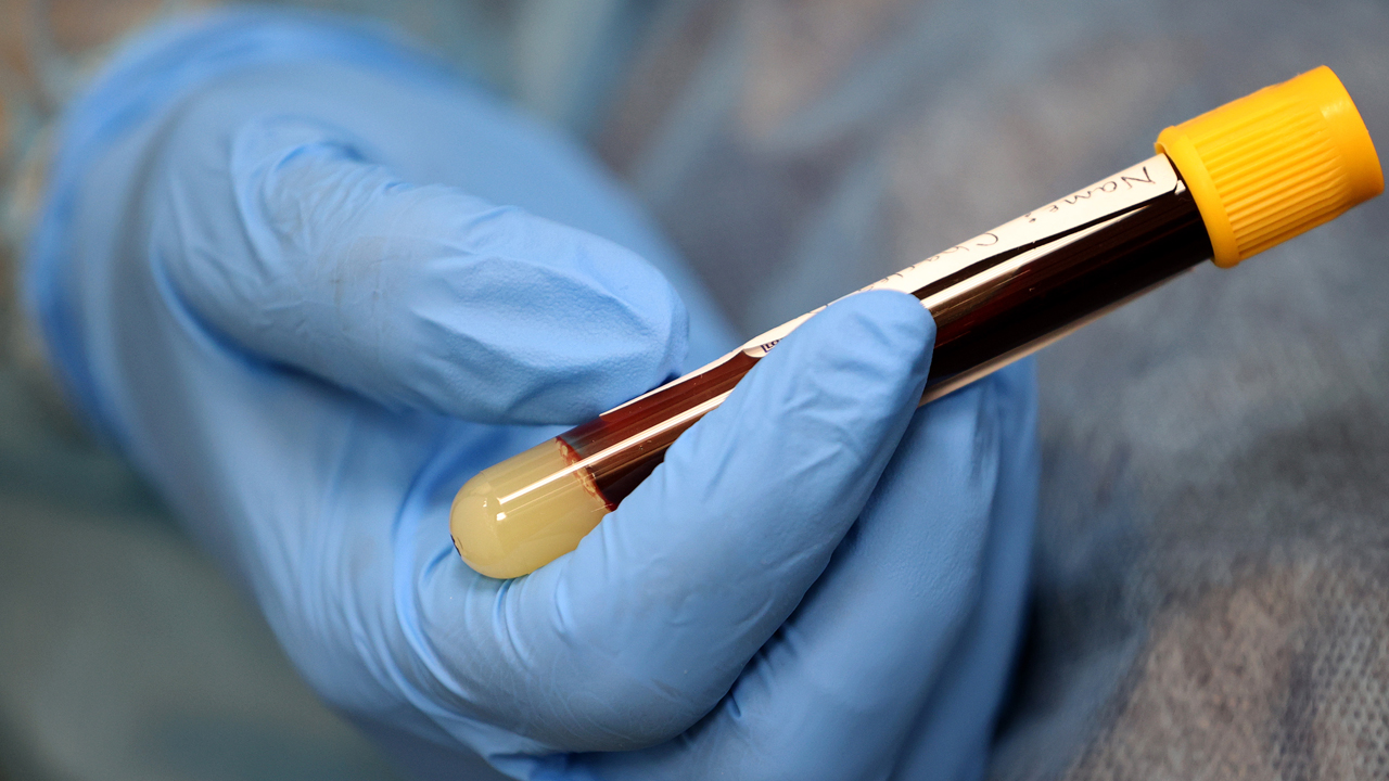 Washington DC District Government Offers Free Antibody Tests For COVID-19