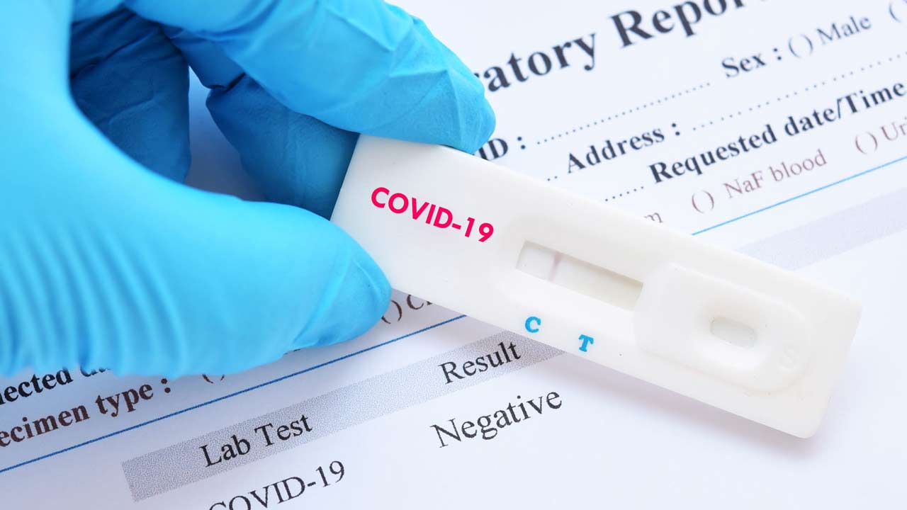 COVID-19-test