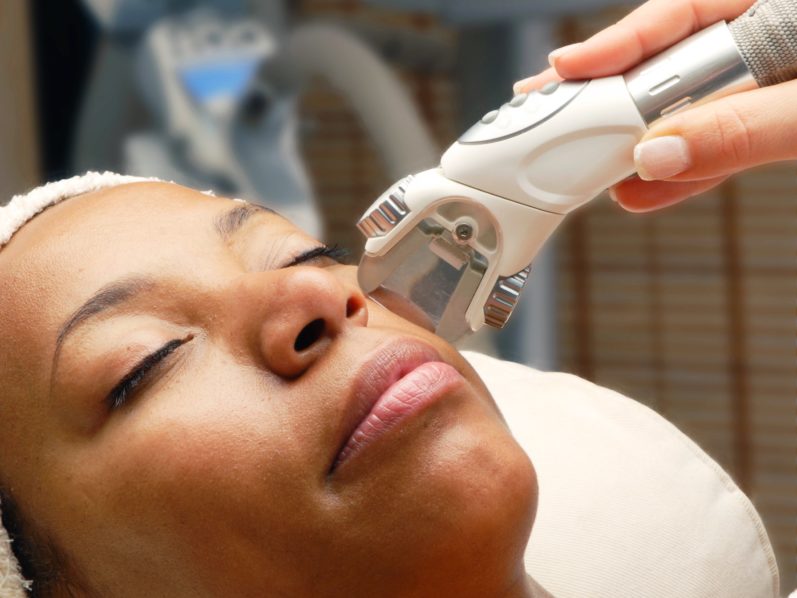 Laser treatment