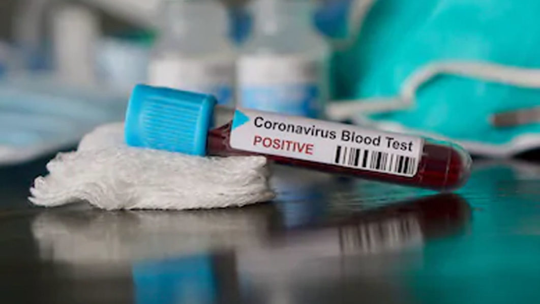 coronavirus test