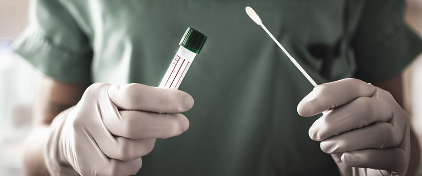 nurse holds a swab for the coronavirus / covid19 test