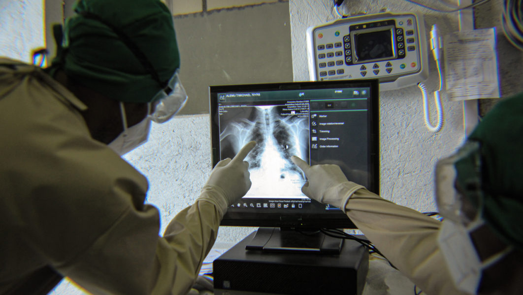 ETHIOPIA-HEALTH-VIRUS-HOSPITAL