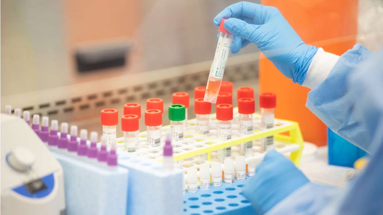 coronavirus-test-kits