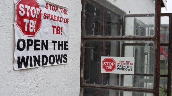 Doctors Without Borders (MSF): Governments off track on providing tools to prevent tuberculosis (TB), the second biggest infectious disease killer after COVID-19