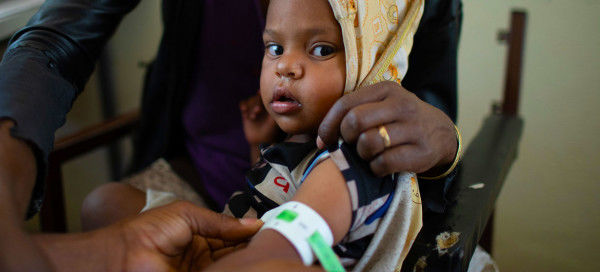 100,000 Children in Tigray at Risk of Death from Malnutrition: UNICEF
