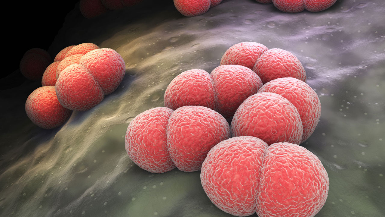 Meningitis